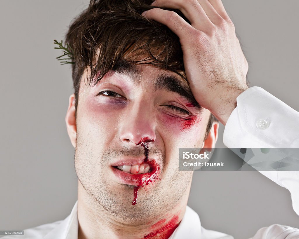 Beaten man Portrait of young injured man touching his head and looking at the camera. 25-29 Years Stock Photo
