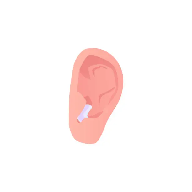 Vector illustration of Hearing aid medical gadget in ear vector illustration, hearing assistance BTE devices with external receiver, microphone