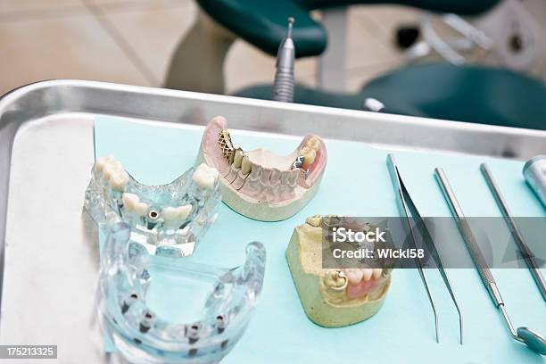 High Tech Postiza Foto de stock y más banco de imágenes de Tecnología - Tecnología, Corona dental, Dentadura postiza