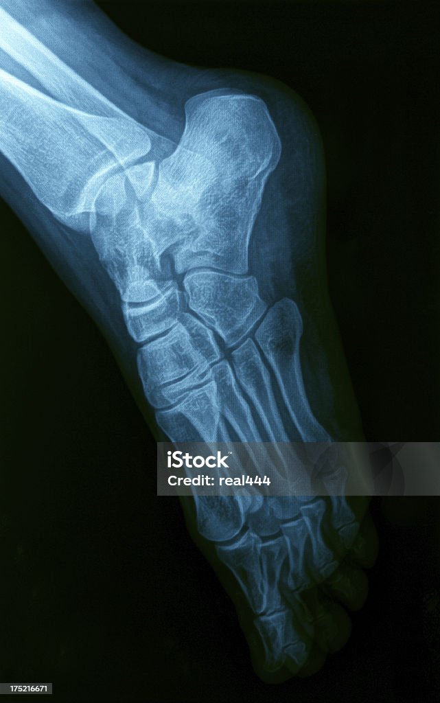 X-Ray image of the Foot. Anatomy Stock Photo