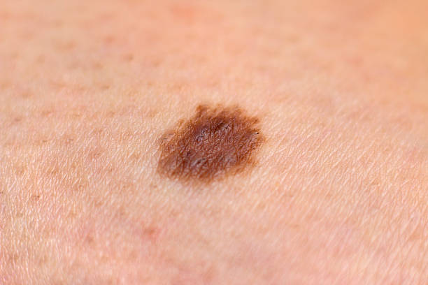 Mole  http://cginspiration.com//Istock/V2/WhiteCharacters.jpg mole skin stock pictures, royalty-free photos & images