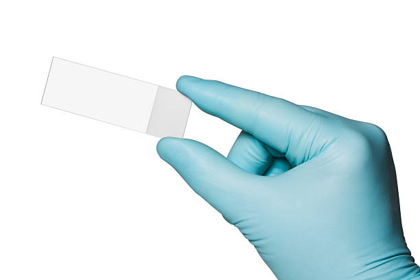 Hand in blue surgical glove holding a glass microscope slide