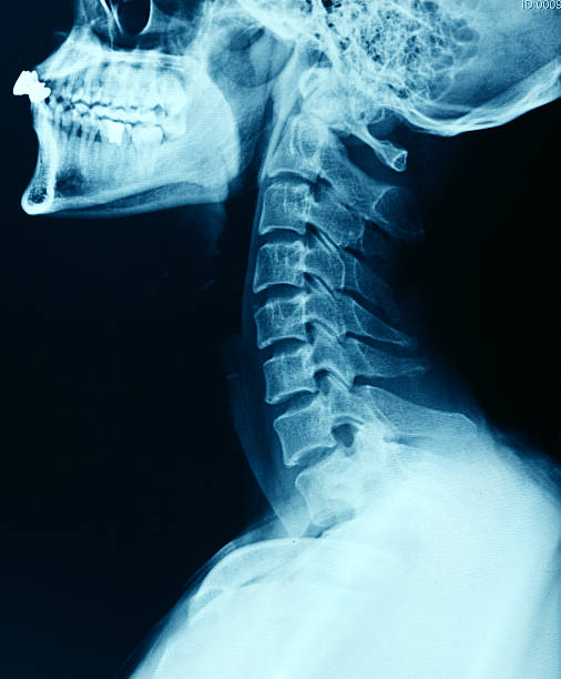 immagine a raggi x - collo umano foto e immagini stock