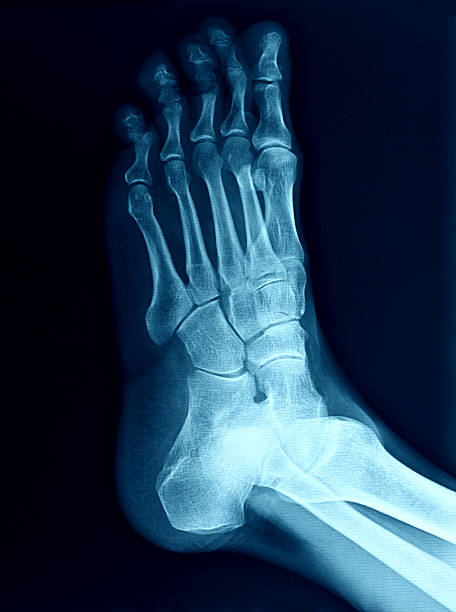 x-ray image des fußes - bending human foot ankle x ray image stock-fotos und bilder