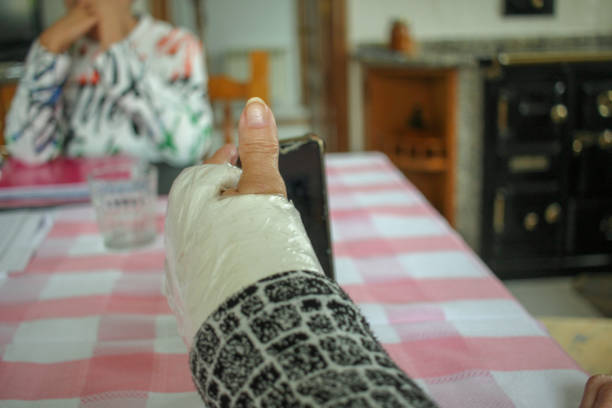Closeup midsection of a woman with broken arm in cast