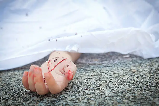 Photo of Bloody hand at an accident scene pavement