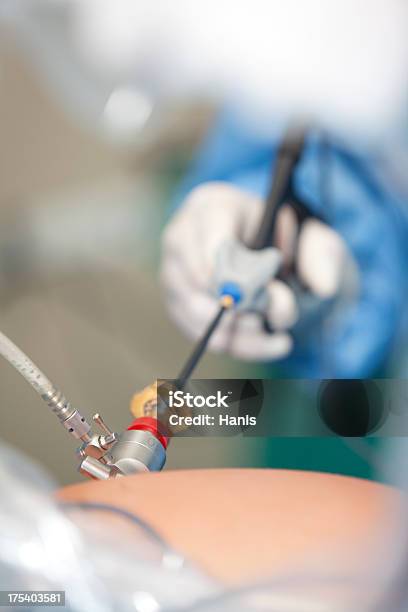 Operation Laparoscopy Stockfoto und mehr Bilder von Krankenhaus - Krankenhaus, Technologie, Laparoskopische Chirurgie