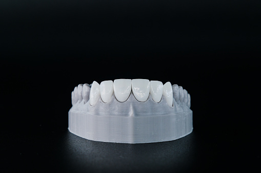 Hollywood designed dental models carefully prepared for premium clinics