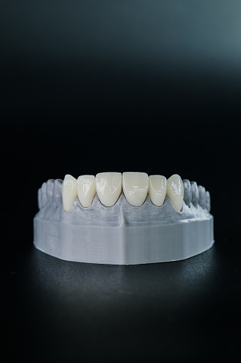 Smile again with the zirconium coating tooth model!