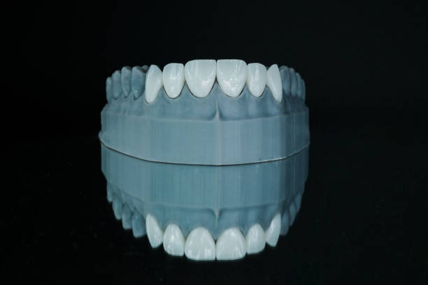 Smile again with the zirconium coating tooth model! stock photo