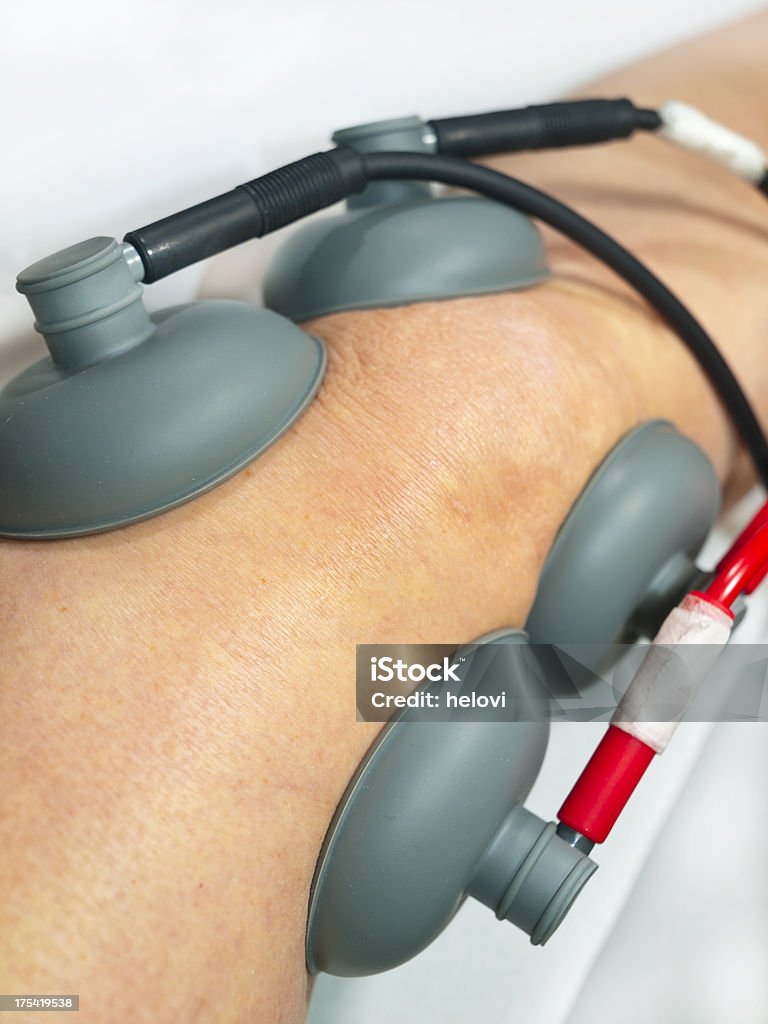 physiotherapy of knee "Patient's knee attached to a four rubber electrodes in a vacuum, connected with wires of an electical stimulation machine. Narrow dof." Cable Stock Photo