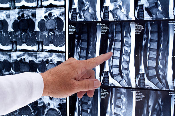 MRI scan of human lumbar spine with doctor stock photo