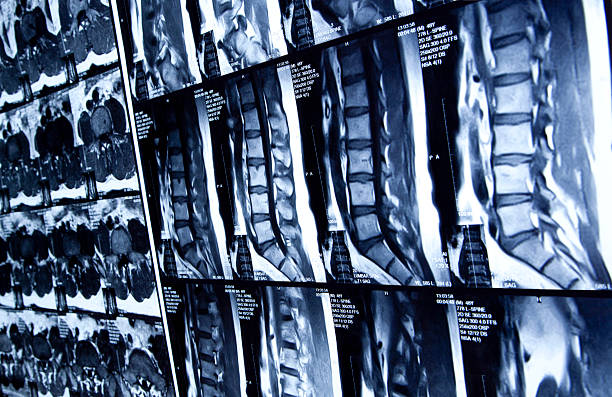 MRI scan of human lumbar spine MRI scan of human lumbar spine monitoring equipment photos stock pictures, royalty-free photos & images