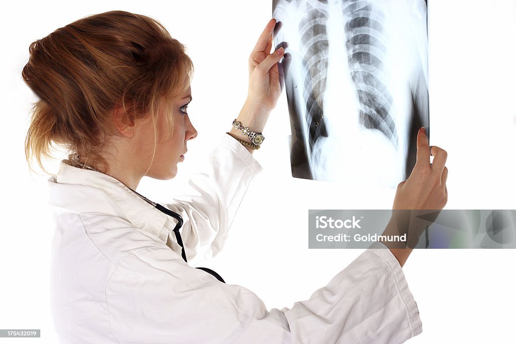 X-Ray płuc - Zbiór zdjęć royalty-free (Badanie lekarskie)
