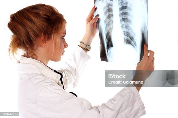 Foto de Xray Pulmões e mais fotos de stock de Adulto - Adulto, Apoio, Atividade