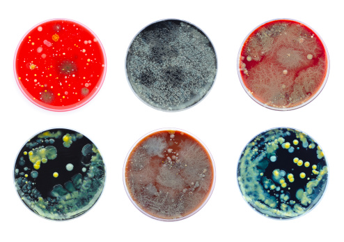 Group of petri dishes with different culture media and micro organisms grown. They show biodiversity in microbiology. Isolated on white background.