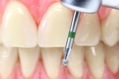 dental drill and tooth model