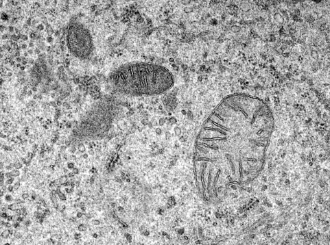 Transmition Electron microscopy of an epithelial cell where mitochondria of several sizes can be seen with the characteristic double membrane and internal cristaes. Mitochondria are believed to be of bacteria origin. It has its own genome and RNA and protein which are similar to those of bacteria.
