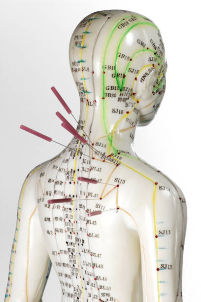 istock female acupuncture model with needles in the shoulder 1754636157