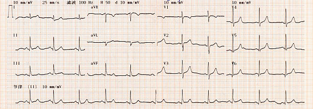 cardiogram tabella (ecg - eeg foto e immagini stock