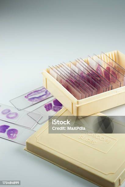 Histología Portaobjetos Con Recipiente Foto de stock y más banco de imágenes de Caja - Caja, Portaobjetos de microscopio, Asistencia sanitaria y medicina