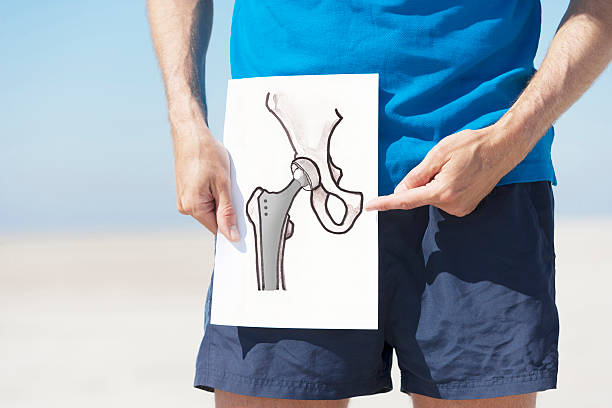 Total hip replacement Drawing of a total hip-joint replacement. XXL size image. femur photos stock pictures, royalty-free photos & images