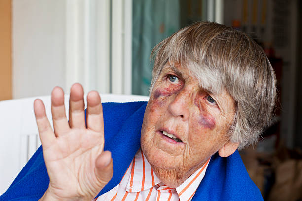 Senior with bruises begging for mercy