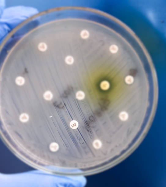 istock Antimicrobial susceptibility testing in culture plate. Drug sensitivity test, disk drug, antibiotic sensitivity, Gentamicin resistance. 1755125085