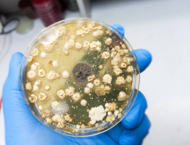 istock Malt Extract Agar in Petri dish using for growth media to isolate and cultivate yeasts, molds and fungal testing from Neil scraping samples. Neil scraping for fungus culture. 1755138296
