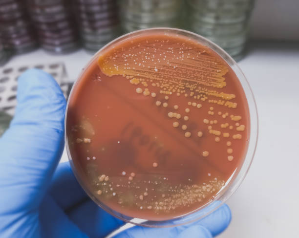 Golden color colonies on chocolate agar medium, growth of staphylococcus aureus, gram positive bacteria at medical microbiology laboratory. Golden staph. Golden color colonies on chocolate agar medium, growth of staphylococcus aureus, gram positive bacteria at medical microbiology laboratory. Golden staph. staphylococcal enterotoxicosis stock pictures, royalty-free photos & images