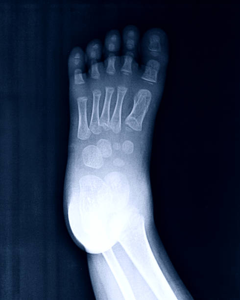 imagerie par rayons x des pieds. - bending human foot ankle x ray image photos et images de collection