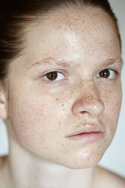 istock Girl With Freckles 175588518