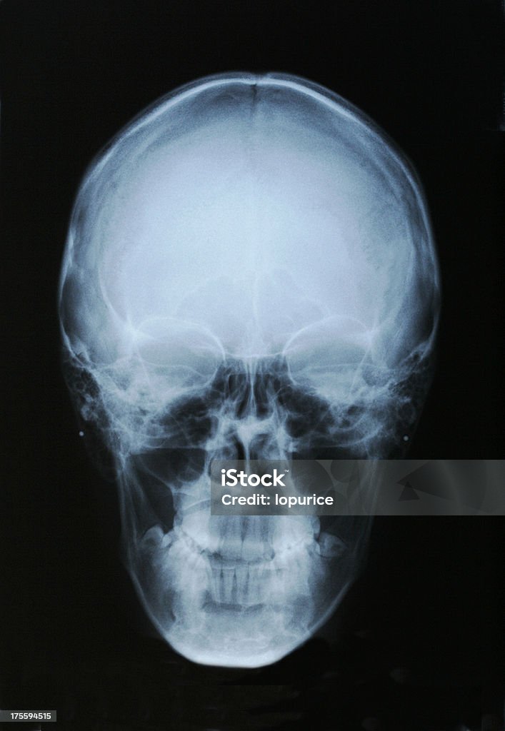 Crânio frente - Foto de stock de Coluna vertebral - Parte do Corpo royalty-free