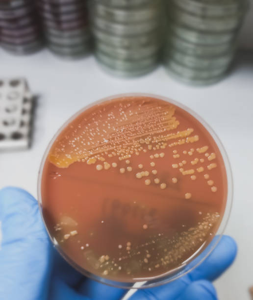 Golden color colonies on chocolate agar medium, growth of staphylococcus aureus, gram positive bacteria at medical microbiology laboratory. Golden staph. Golden color colonies on chocolate agar medium, growth of staphylococcus aureus, gram positive bacteria at medical microbiology laboratory. Golden staph. staphylococcal enterotoxicosis stock pictures, royalty-free photos & images