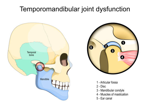 Temporomandibular joint dysfunction syndrome. Side view of a Human skull vector art illustration