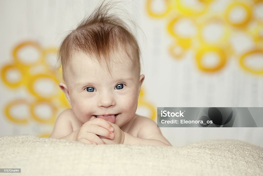 cheerful little baby girl with Downs Syndrome Down Syndrome Stock Photo