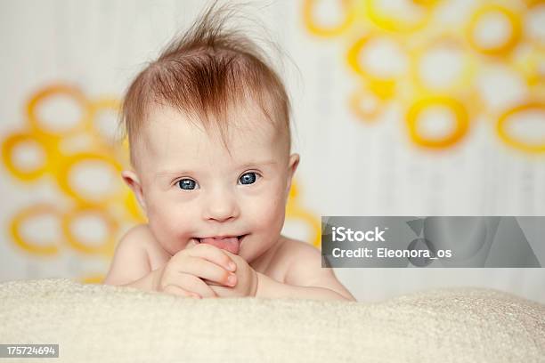 Cheerful Little Baby Girl With Downs Syndrome Stock Photo - Download Image Now - Down Syndrome, Baby - Human Age, Newborn