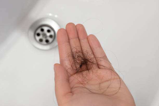 istock Woman suffering from hair loss 1758210422