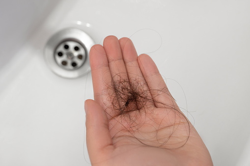 Woman suffering from hair loss