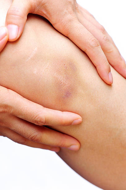 istock woman holding sore leg 175869793