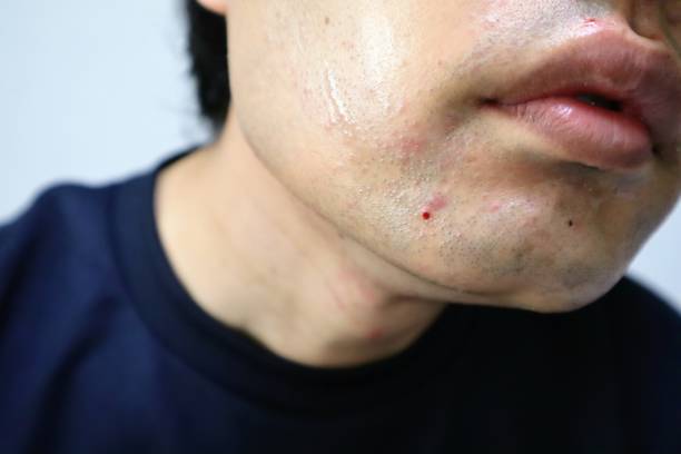 istock A man did skin care after shaving 1758923195