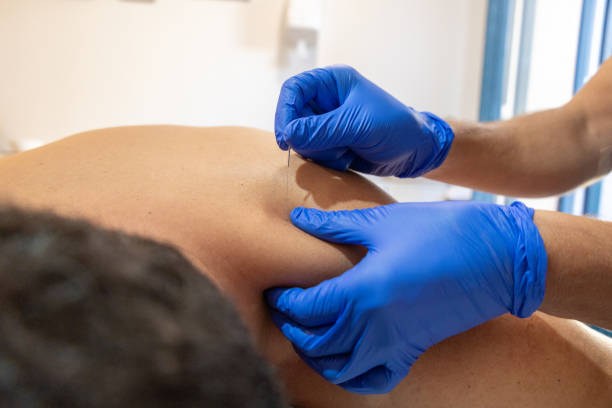 istock Expert physiotherapist applying acupuncture for pain relief. 1759437482