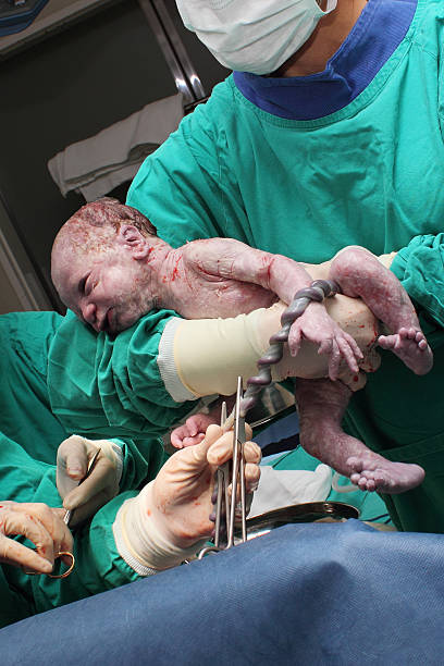 istock New born Baby with umbilical cord 175949179