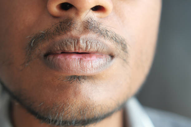 istock Close up of a young men hand dry lips 1760175079
