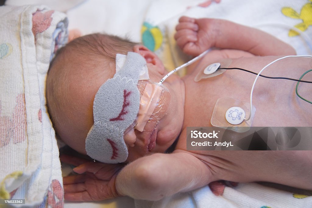 Prematuro neonato in ospedale - Foto stock royalty-free di Bebé