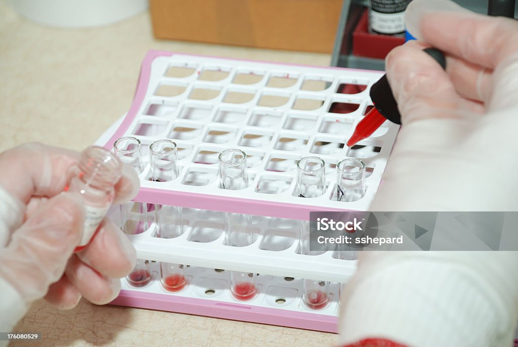 Test tube blood samples Healthcare worker placing samples in test tubes Beauty Stock Photo