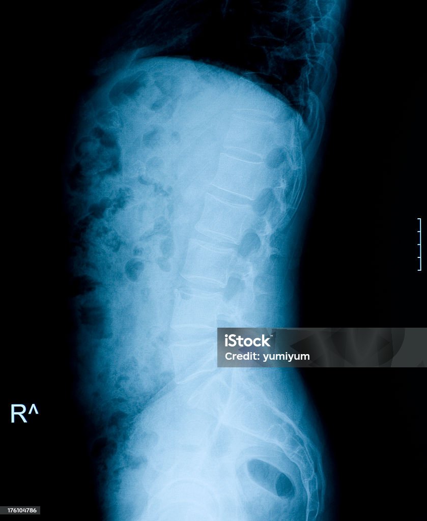 Imagerie par rayons X de Vertèbre lombo-sacrée - Photo de Anatomie libre de droits