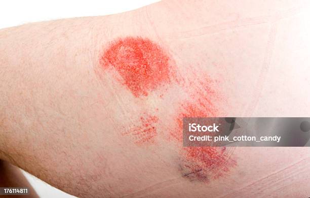 自転車レック Road ラッシュヒップ - 傷のストックフォトや画像を多数ご用意 - 傷, 臀部, カッコいい