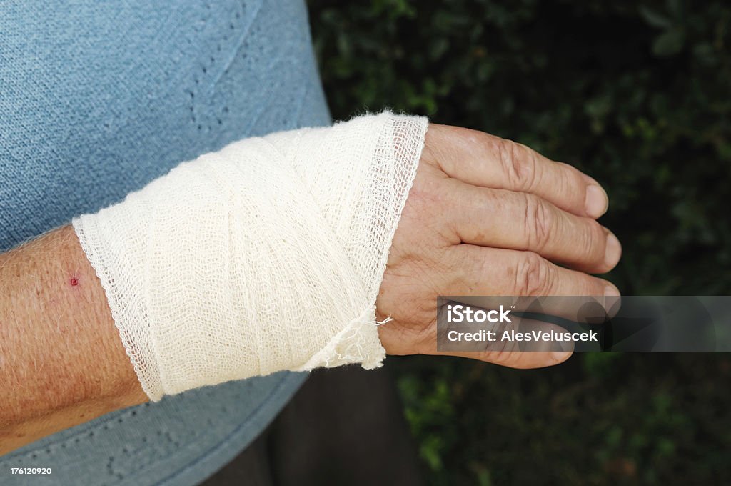 Lesionado mano - Foto de stock de Articulación humana libre de derechos