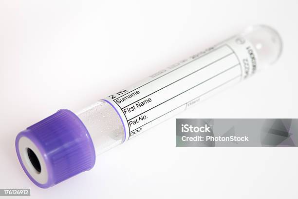 보라색 바이알 On 회색 배경 시험관에 대한 스톡 사진 및 기타 이미지 - 시험관, 의료 샘플, 배관